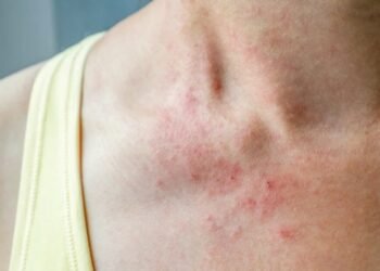 Dust Allergy Troubles? Simple Home Changes That Can Help You Breathe Easy